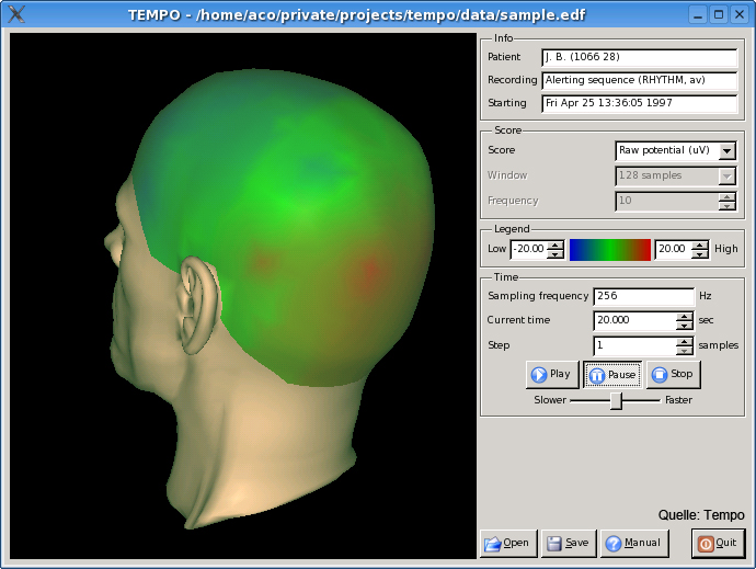 Tempo EEG Darstellung